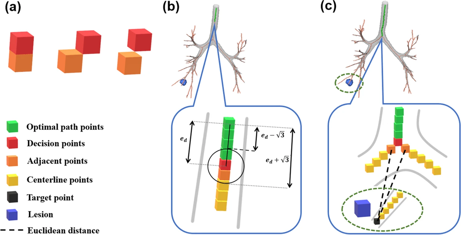China and Iran Collaborate to Develop Electromagnetic Navigation Bronchoscope Prototypes