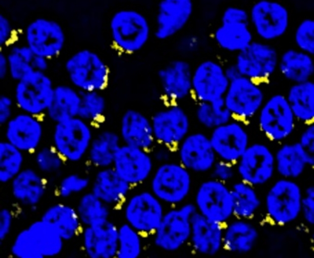 Novel Insight into Hallmarks of Ovarian Aging in Mammals