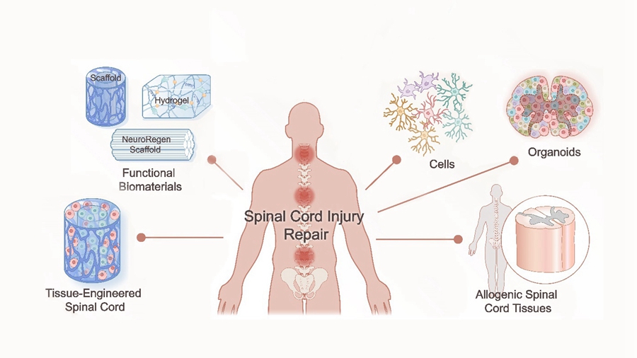 Research in Biomaterial-Based Spinal Cord Injury Repair Exhibits Great Potential in Clinic