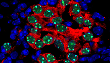 Researchers Analyze Single-cell Transcriptome and Developmental Trajectory of Otic Neuronal Lineage in Early Mouse Embryo