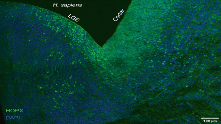 Researchers Reveal Evolutionarily Conservative and Non-conservative Regulatory Networks during Primate Interneuron Development