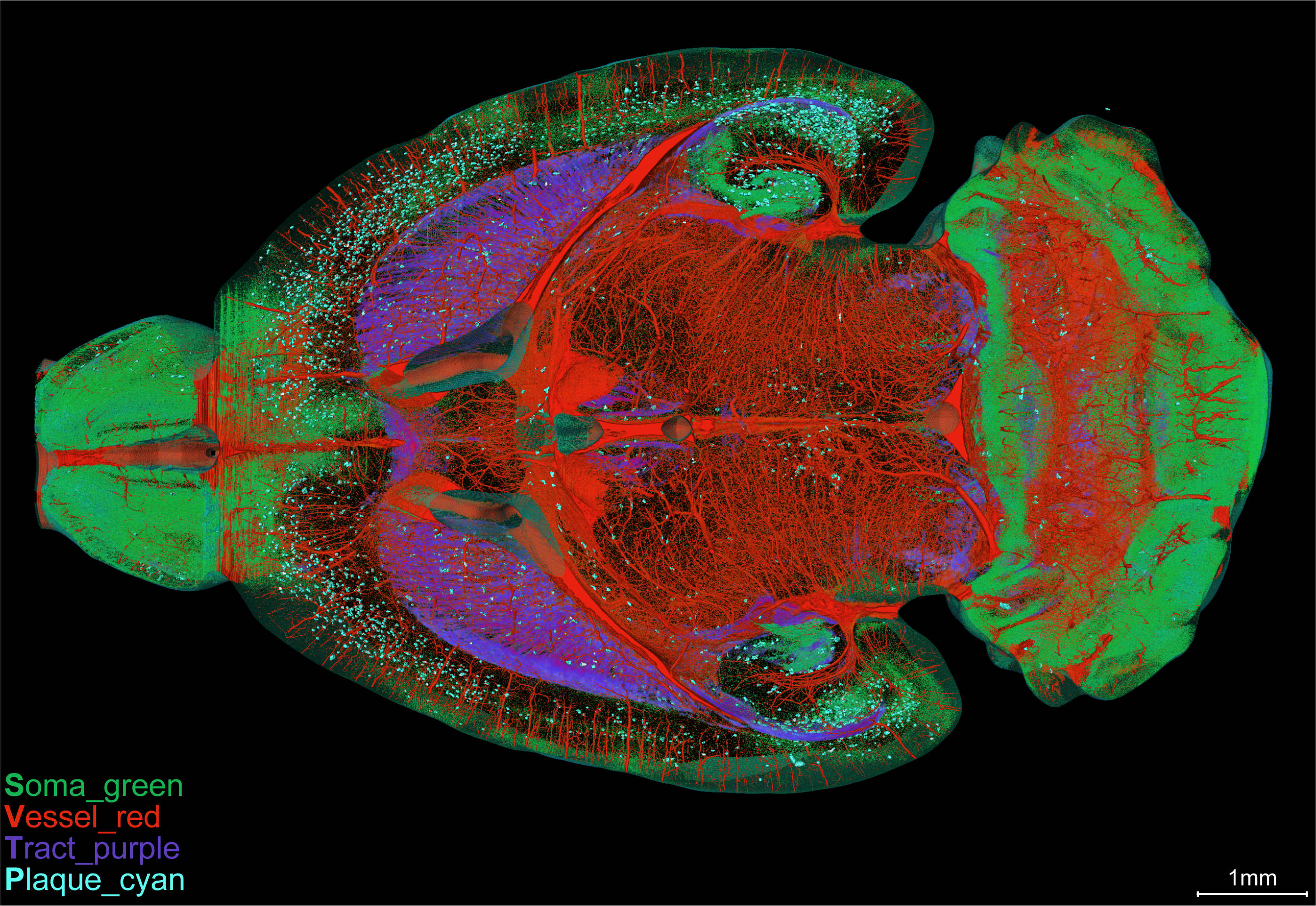 Researchers Reconstruct Whole-brain Panorama of Multiple Structures in Alzheimer's Disease Mice