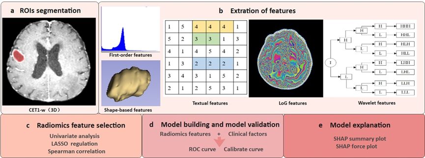 Radiomic Model Helps Predict Radiotherapy Treatment Response in Patients with Brain Metastases