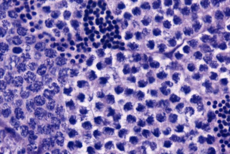 Fish Female-biased Gene cyp19a1a Leads to Female Antiviral Response Attenuation Between Sexes