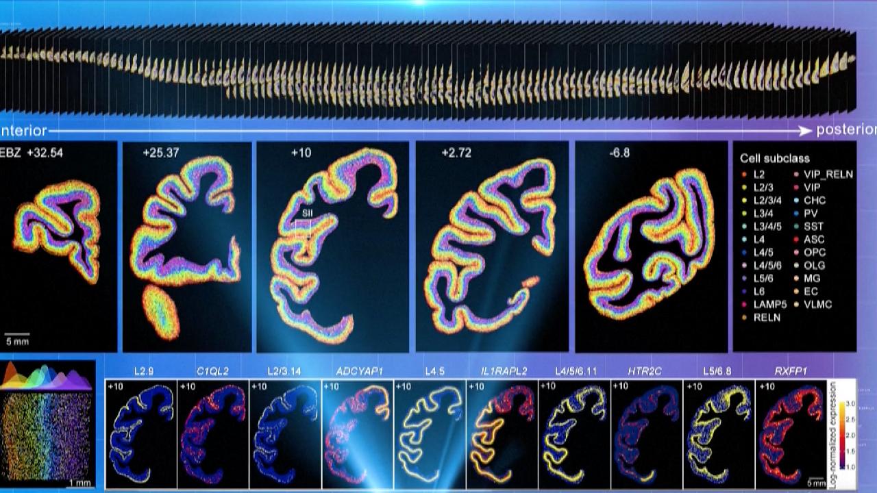 Chinese Researchers Achieve Key Brain Diseases Breakthrough