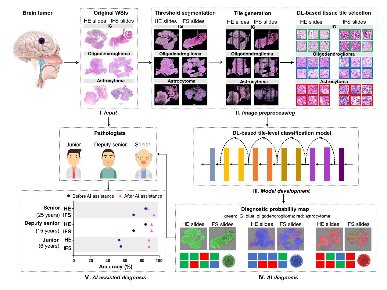 Researchers Propose Intelligent Rapid Diagnosis Method for Neuropathology