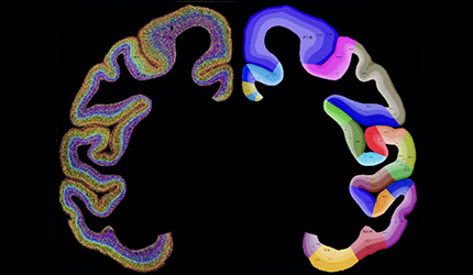 Scientists Map Single-cell Spatial Distribution Atlas of Macaque Cortex