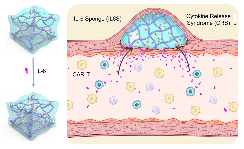 Researchers Propose Novel Strategy in Prevention of CAR-T Cell-induced Cytokine Release Syndrome