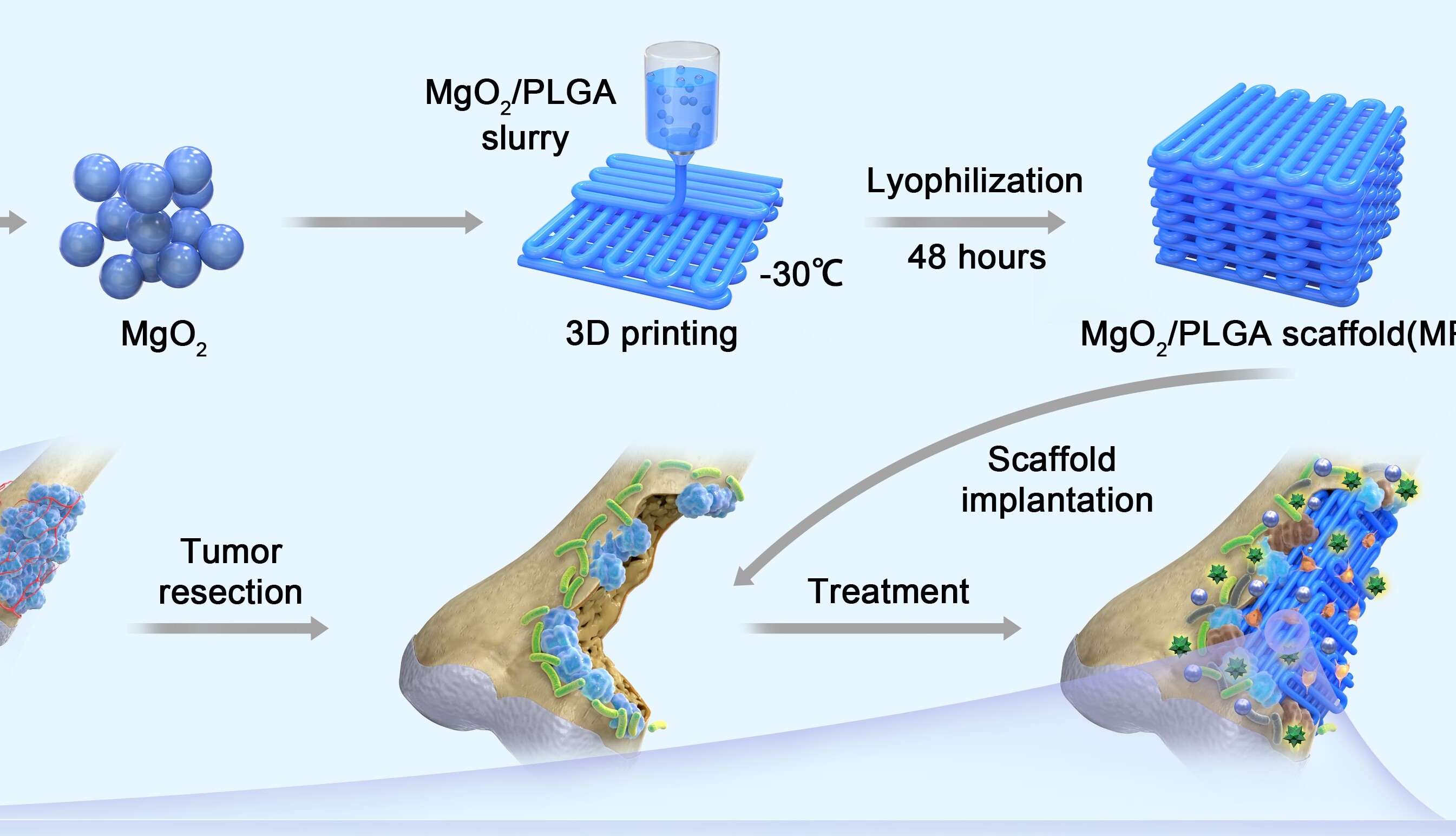 Time-sequential and Multi-functional 3D Printed Scaffold Provides Strategies for Postsurgical Osteosarcoma Treatment