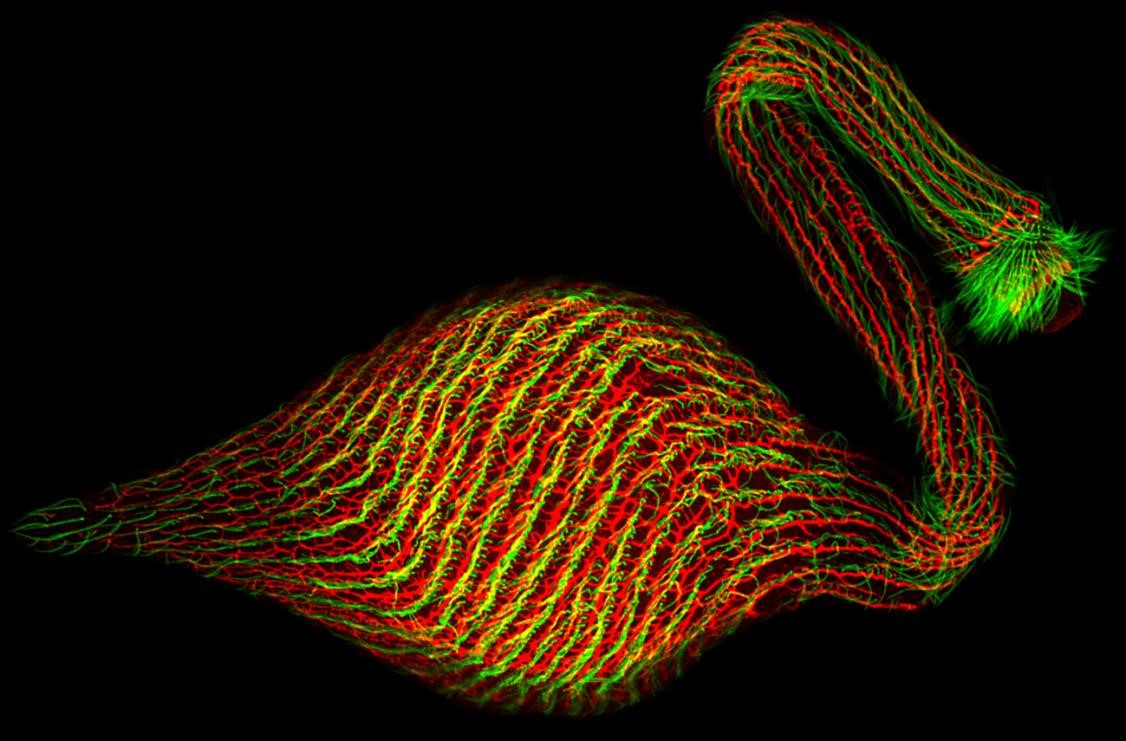 Researchers Clarify Role of Novel Cytoskeletons in Eukaryotic Cell Shape-shifting