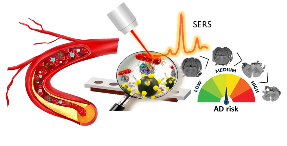 Aptamer-SERS Biosensors Helps Early Alzheimer’s Detection