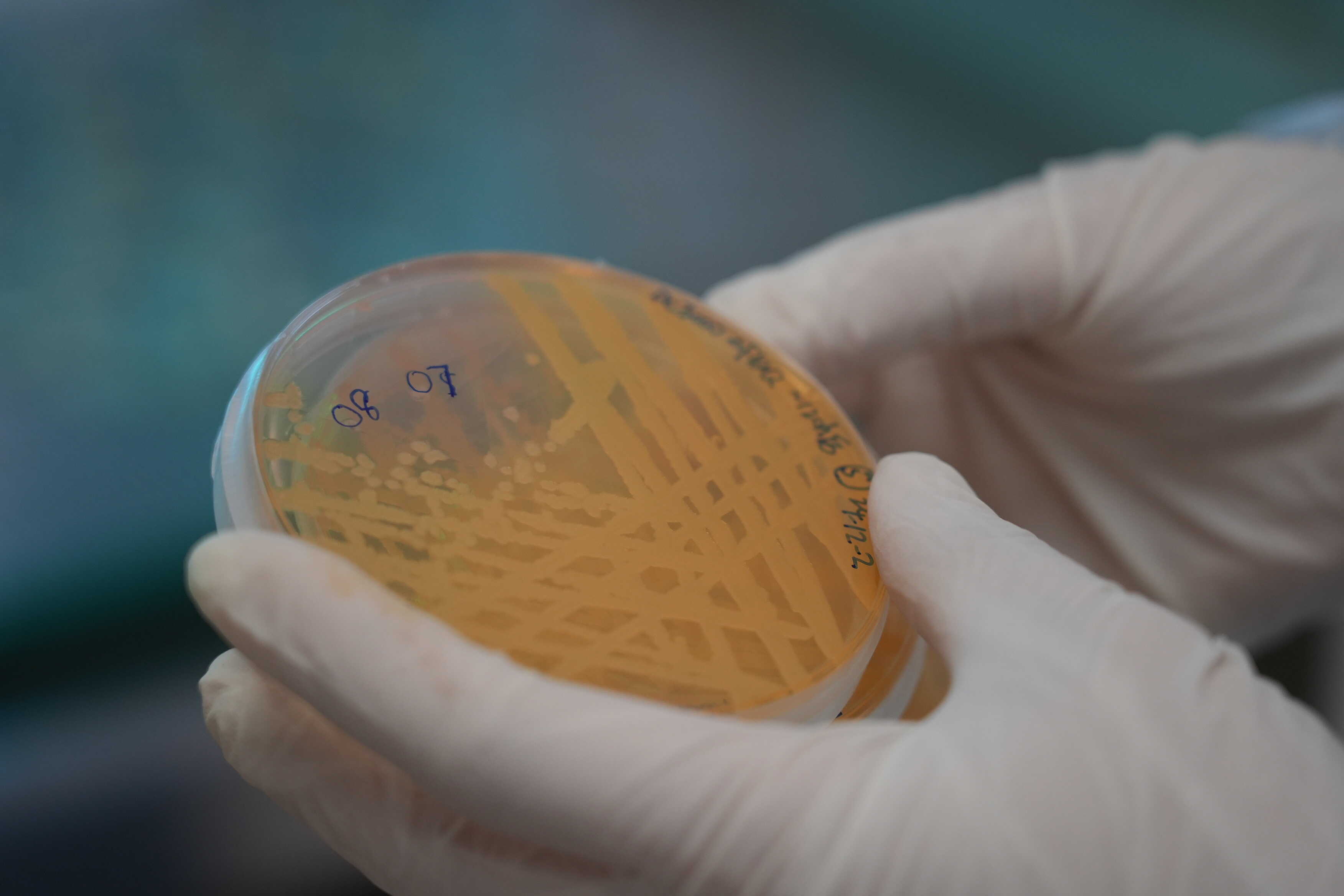 Flagella-Free Survival: How Bacteria Evolve by Shedding Their 