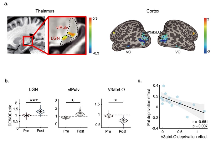 Study Reveals Dual Mechanisms Driving Rapid Ocular Dominance Plasticity in Adult Brain