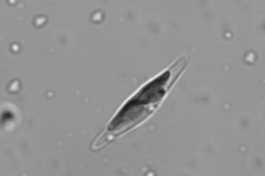 Bacterial-Algal Interactions Shape Diatom Adaptation to Carbon Changes