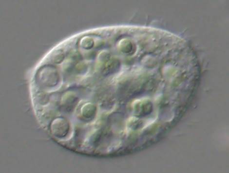 Tetrahymena.jpg
