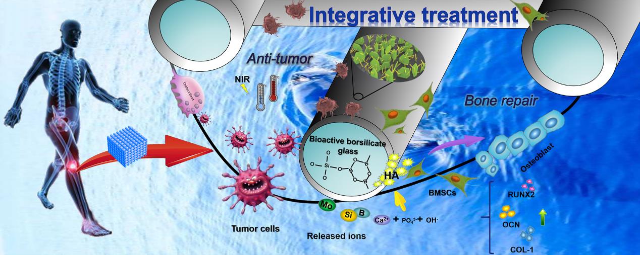 Researchers Develop Integrative Treatment of Tumor-related Bone Defects