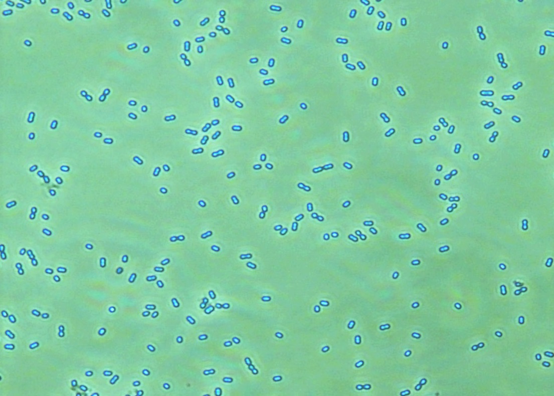 Researchers Identify Structure and Function of First Deacylase Enzyme CddA in Cyanobacteria
