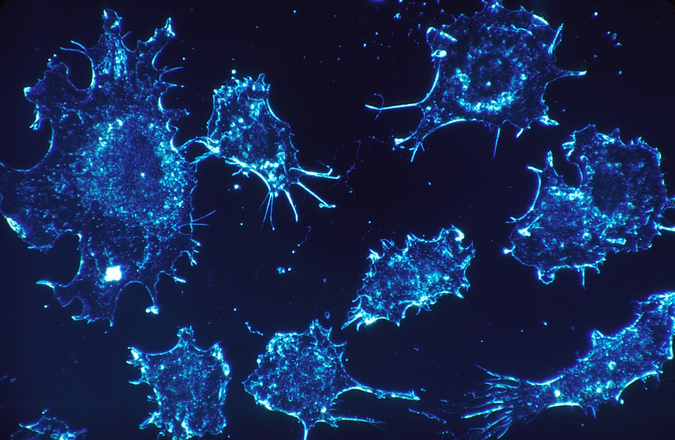 tumor cells.jpg