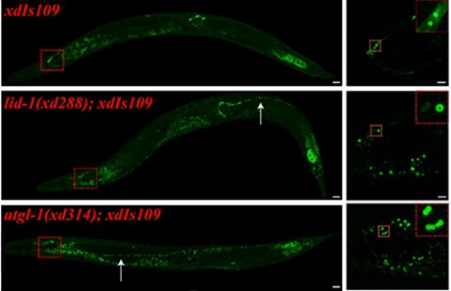 Lipid Droplet Dynamics in Neurons Regulates Neurodegeneration