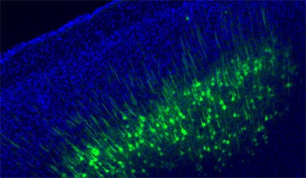 A cortico-collicular pathway for motor planning in a memory-dependent perceptual decision task.jpg