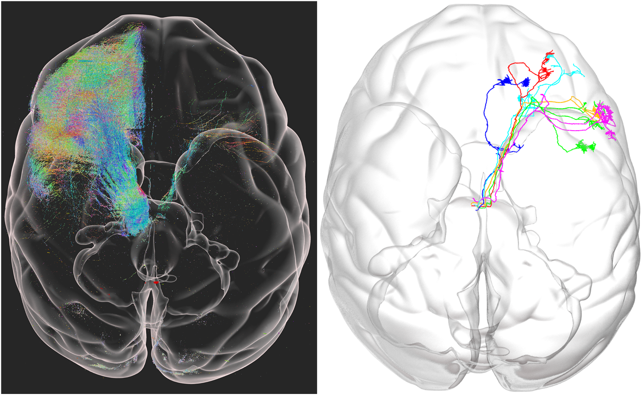 Whole Brain Mapping of Primates Enters Micron Era