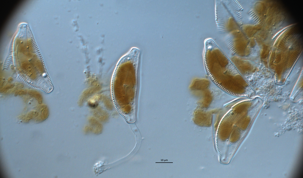 Benthic Metabolism Linking to Algal Community Metrics Responds to Environmental Attributes