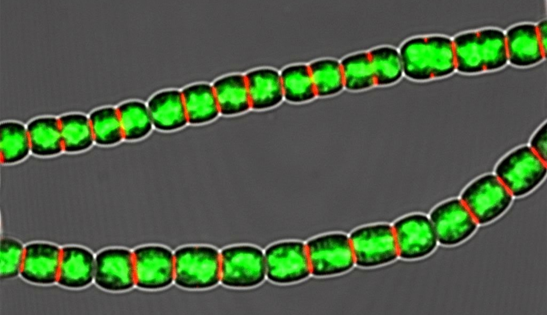 Fluorescent image of the filamentous cyanobacterium Anabaena PCC 7120. (Image by IHB)