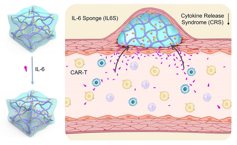 Schematic diagram of IL-6 sponge in prevention of CAR-T induced cytokine release syndrome. (Image by LIANG Xingjie et al.)