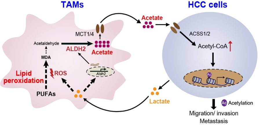 Lactate–acetate Interaction Between Tumor-associated Macrophages and Cancer Cells Drives Hepatocellular Carcinoma Metastasis