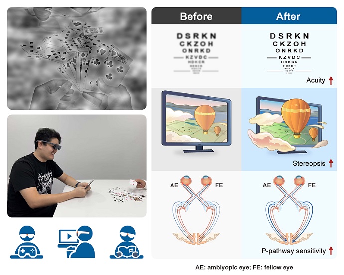 New AR Technology Boosts Vision in Adults with Amblyopia