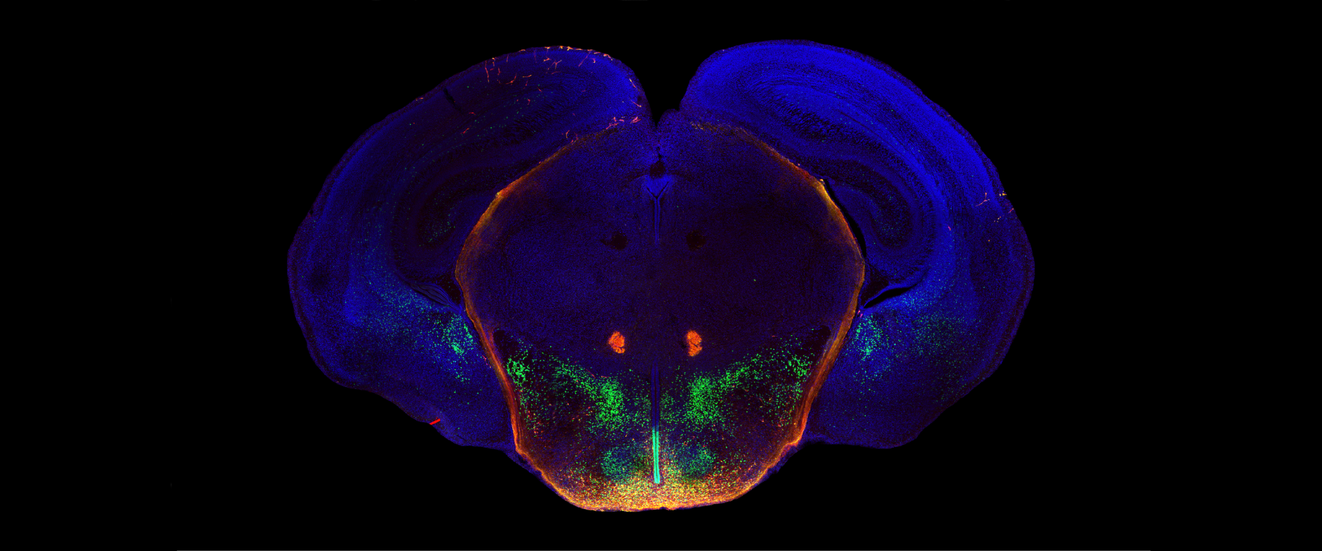 How is Puberty Onset Developmentally Programmed?